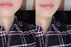 美颜相机中如何进行嘴巴矫正？