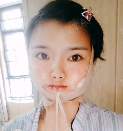 美颜相机中如何进行嘴巴矫正？  第3张